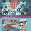 TEXTBOOK OF GYNAECOLOGY | SHEILA BALAKRISHNAN | PARAS MEDICAL PUBLISHER