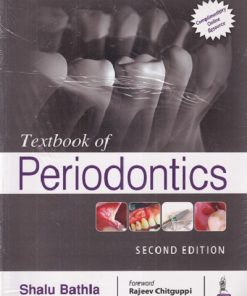 TEXTBOOK OF PERIODONTICS | SHALU BATHLA